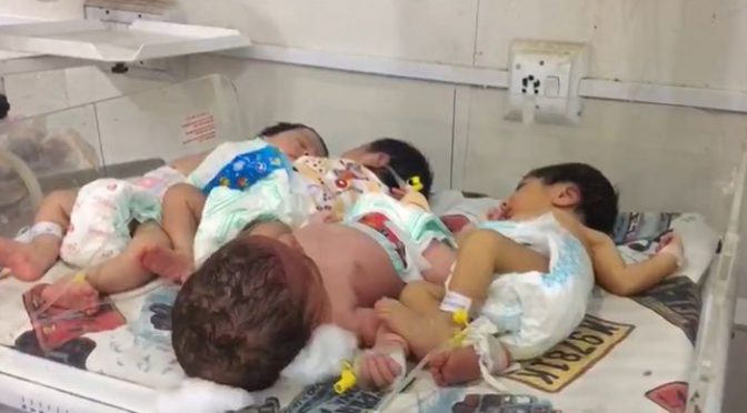 پشاور کے ہسپتالوں میں بیک وقت ایک انکو بیٹر پر متعد دبچے زیر علاج