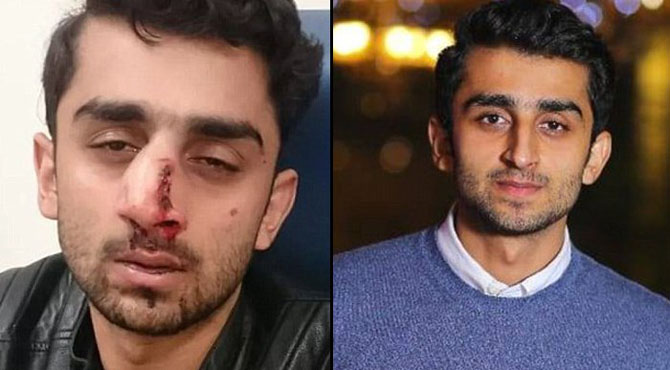 اپنے ملک دفع ہو جاﺅ ، آسٹریلیا بھی مسلم مخالف نکلا نسل پرستوں کا پاکستانی طالب علم پر بے رحمانہ تشدد