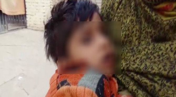 سنگدل والدین کا معذور نو عمر بچی کیساتھ سفاکانہ اقدام ،ویرانے میں پھینک دیا،کتُوں نے کیا حال کر دیا؟دیکھئے خبر