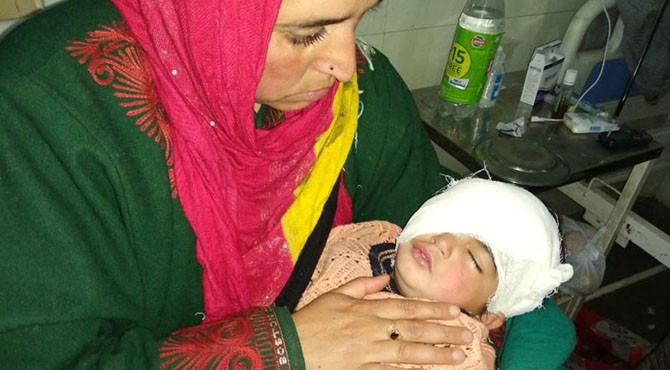 بھارتی فوج کے اندھے جنون کا شکار معصوم حبا کے آنکھ کا آپریشن کامیاب