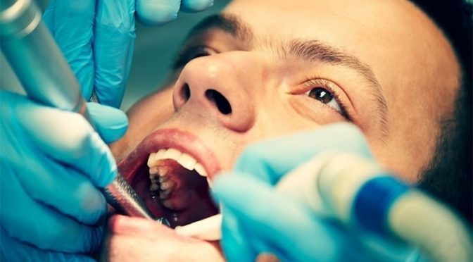 دانتوں کا تکلیف دہ طریقہ علاج ماضی کا قصہ بننے کے قریب