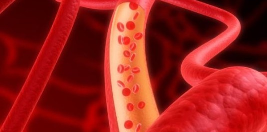 شریانوں کی صفائی اور خون کا بہاﺅ بہتر بنانے قدرتی نسخہ