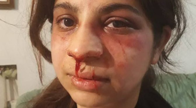 لاہورمیں خاوند کا بیوی پر بیہمانہ تشدد کا ایک اور واقعہ،لہو لہا ن کر دیا