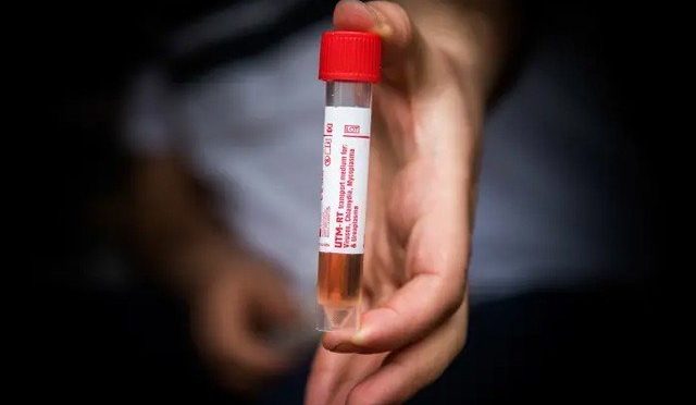 اسرائیل میں کورونا وائرس میں مبتلا شہری کا ’پیسیوامیونائزیشن‘ سے علاج