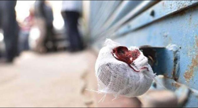 ایس او پیز کی خلاف ورزیاں ، 709سے زائد مارکیٹ اور دکانیں سیل