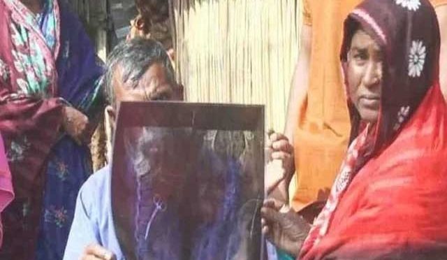 خاتون کے پیٹ سے 20 سال بعد قینچیاں نکال لی گئیں