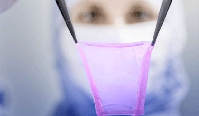 سائنسدانوں نے مریض کی جلد چھاپنے والی مشین تیار کرلی