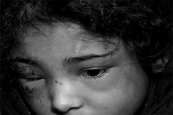 فیصل آباد: گذشتہ برس کم سن بچوں پر تشدد کے 20 سے زائد کیسز رپورٹ