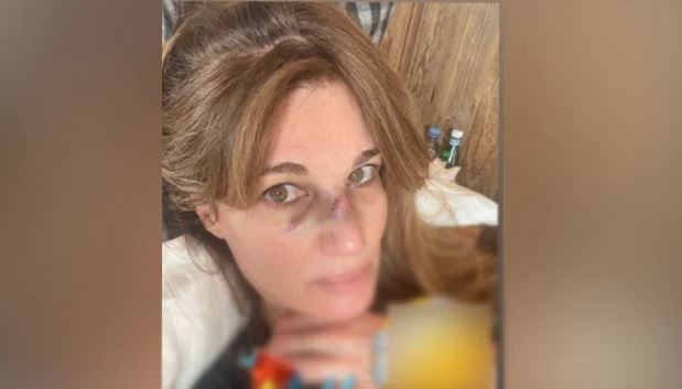 جمائما گولڈ اسمتھ زخمی ہوگئیں