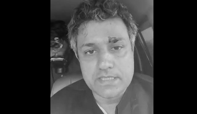 پی ٹی آئی رہنما حماد اظہر آنسو گیس کا شیل لگنے سے زخمی