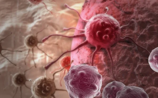 سندھ کے سرکاری اسپتالوں میں کینسر علاج کی سہولت نہ ہونے کے برابر