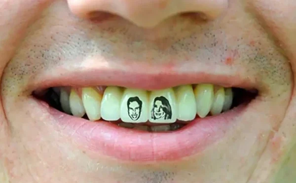 چینیوں میں دانتوں پر ٹیٹو بنوانے کا فیش مقبول ہونے لگا