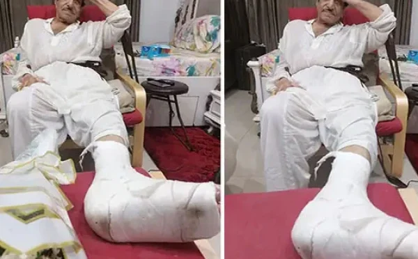 کراچی کی ٹوٹی پھوٹی سڑکوں سے مصطفیٰ قریشی کی ٹانگ ٹوٹ گئی، سر پر چوٹیں