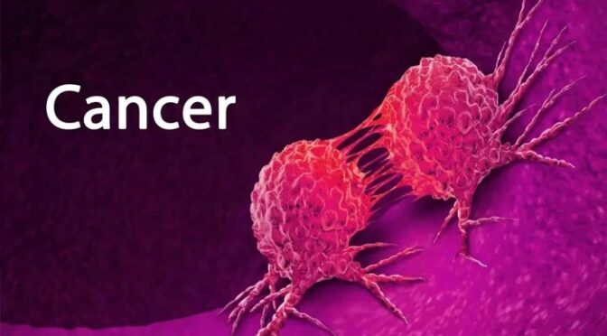 سبزیاں کینسر کی 5 جان لیوا اقسام سے تحفظ فراہم کرنے کیلئے بہترین