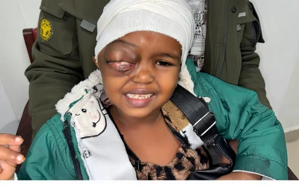 الشفاء ٹرسٹ آئی ہسپتال میں چھ سالہ صومالیہ بچی کی آنکھ میں رسولی کا کامیاب آپریشن