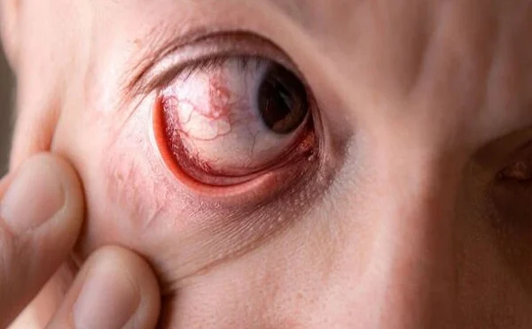 وزن کم کرنے کے انجیکشن سے بینائی جانے کا خطرہ بڑھ سکتا ہے: تحقیق