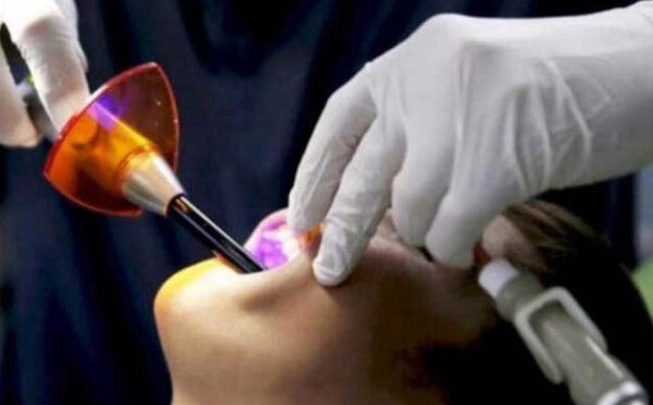 منہ کے جراثیم اعصابی بیماری کو بھی بگاڑ سکتے ہیں، تحقیق