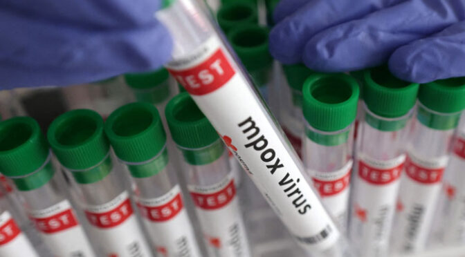 خیرپور میں منکی پاکس کی وبا کی وفاقی سطح پر تحقیقات، ماہرین کی ٹیم اسلام آباد سے روانہ