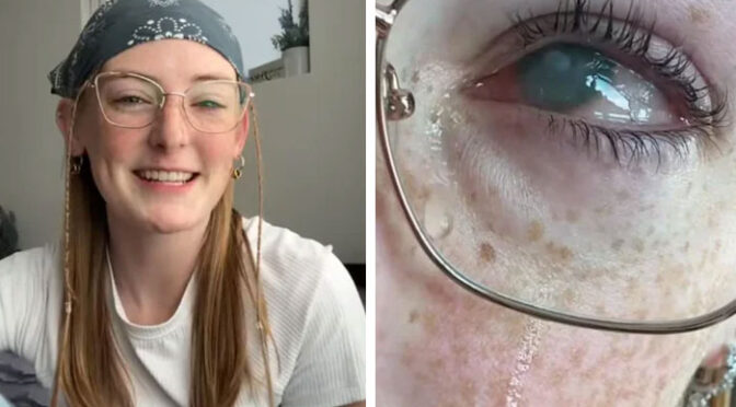 کانٹیکٹ لینز پہن کر نہانے والی لڑکی دونوں آنکھوں کی بینائی سے محروم