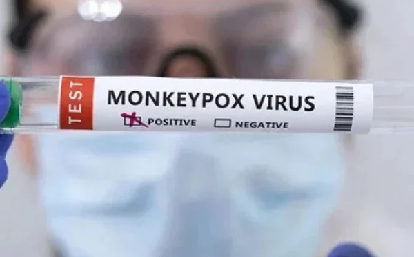 خیرپور میں بچوں میں منکی پاکس وبا کی تصدیق کردی گئی