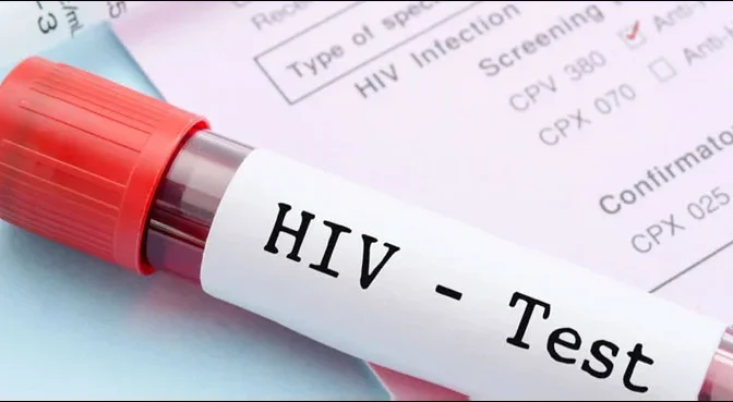 پاکستان میں ایچ آئی وی جیسے مہلک مرض نے خطرے کی گھنٹی بجا دی