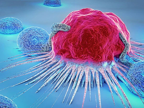 کم عمر افراد میں بڑھتے کینسر کی ممکنہ وجہ کی نشاندہی