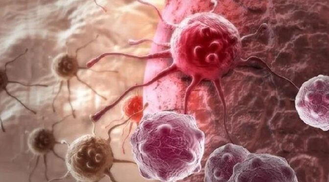 دنیا بھر میں جوان افراد میں تیزی سے کینسر پھیلنے کی اہم ترین وجہ دریافت